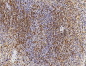 CD4 Recombinant antibody