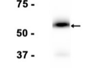CD4 Recombinant antibody
