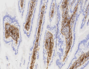 CD9 Recombinant antibody