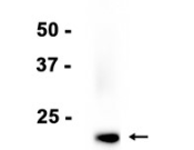 CD9 Recombinant antibody