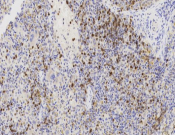 CEACAM1 Recombinant antibody