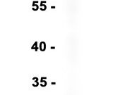 CEACAM1 Recombinant antibody