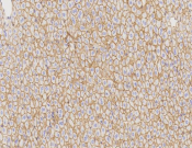 ALCAM Recombinant antibody