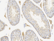 ALDH7A1 Recombinant antibody