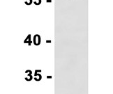 ALDH7A1 Recombinant antibody