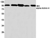 Alpha Actinin Recombinant antibody