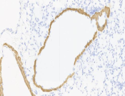 Cardiac Troponin T Recombinant antibody