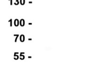 Cardiac Troponin T Recombinant antibody