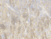 CD147 Recombinant antibody