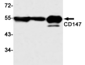 CD147 Recombinant antibody