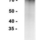 CD19 Recombinant antibody