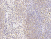 CD19 Recombinant antibody