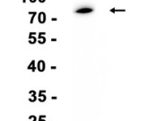 CD204 Recombinant antibody