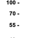 CD21 Recombinant antibody