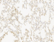 CD22 Recombinant antibody