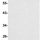 CD22 Recombinant antibody