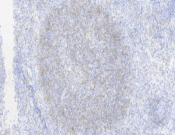 CD23 Recombinant antibody