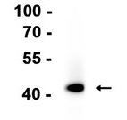 CD23 Recombinant antibody
