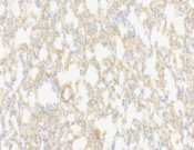 CD34 Recombinant antibody