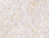 CD44?Recombinant antibody