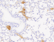 CD55 Recombinant antibody