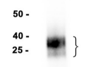 CD8a Recombinant antibody