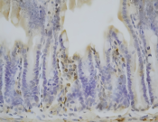 GCLM?Recombinant antibody