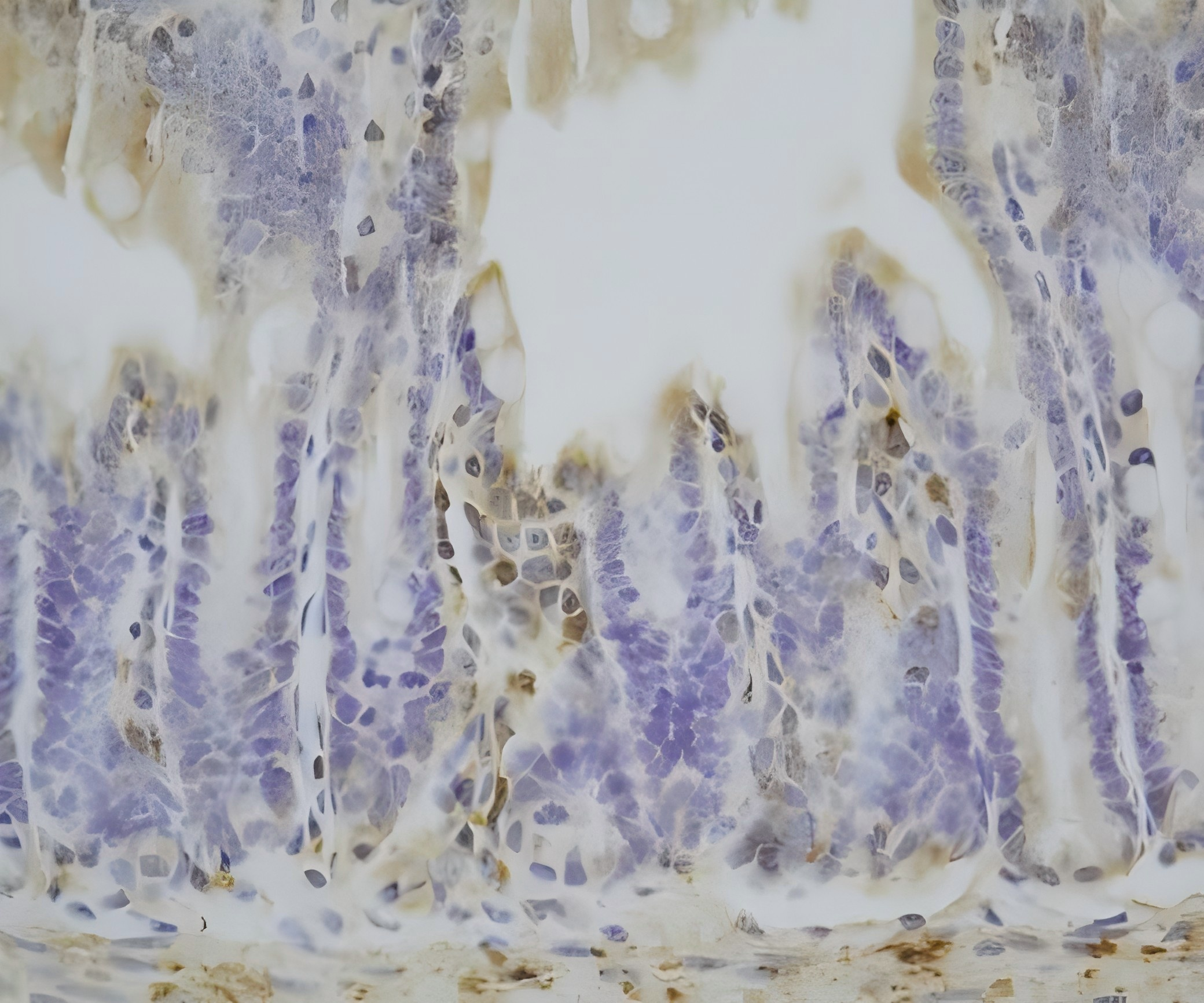 GCLM?Recombinant antibody