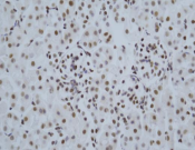 HDAC1?Recombinant antibody