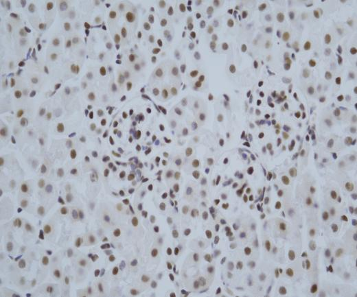 HDAC1?Recombinant antibody