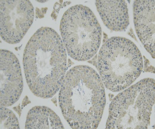 HNRNPC?Recombinant antibody