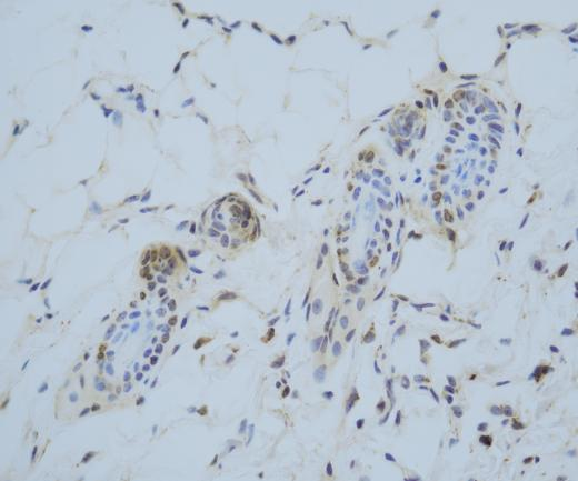 HSP47?Recombinant antibody
