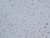 IFT88?Recombinant antibody