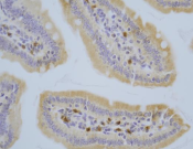 IL-1RA?Recombinant antibody