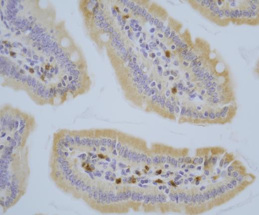 IL-1RA?Recombinant antibody