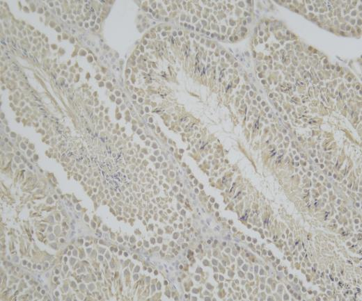 IQUB?Recombinant antibody