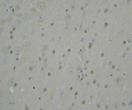 KIAA1715?Recombinant antibody