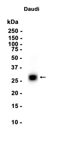 MHC Class II beta Recombinant antibody