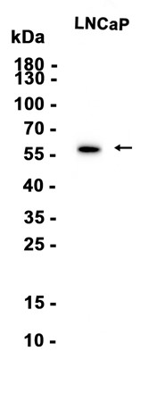 Phospho-AKT1 (Ser473) Recombinant antibody