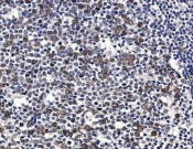 Phospho-CDK2 (Thr14) Recombinant antibody